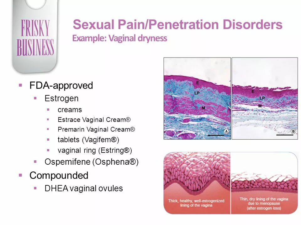 Menopause and Vaginal Dryness: Solutions for Comfort