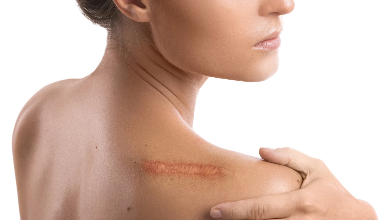 Estrogen and skin repair: how hormones affect wound healing and scarring