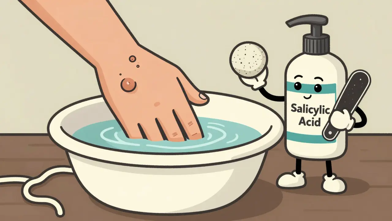 Personified salicylic acid and tools treating a wart in a vintage cartoon style.
